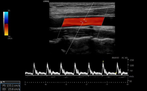 Screenshot of of a vascular scan